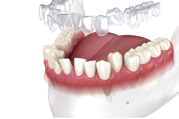 Medical Animation 1